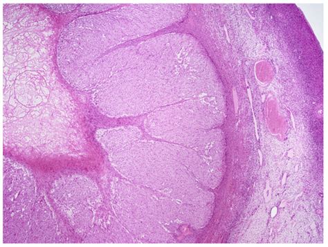 Reproductive ovary (corpus luteum) histology Diagram | Quizlet