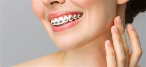 Exploring Alternative Solutions to Traditional Braces - Aurora Dental Group