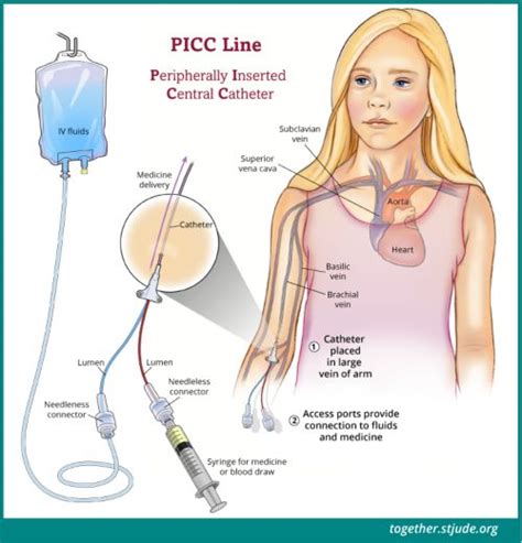 PICC Line | Child life specialist, Nursing school essential, Nursing student tips