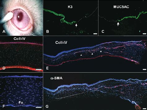 Normal control cornea. Haematoxylin staining (A). Keratin 3 (K3) is... | Download Scientific Diagram