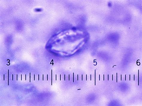 Pathology Outlines - Cyclospora cayetanensis