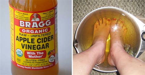 If You Soak Your Feet In Apple Cider Vinegar, THIS Is What Happens… That's Amazing!