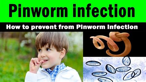 Pinworm infection | How to prevent from Pinworm infection | home ...