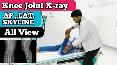 knee joint xray position | AP, Lat. Skyline view | Skyline view X-ray ...