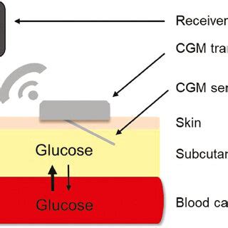 Components of a CGM system (scheme). | Download Scientific Diagram