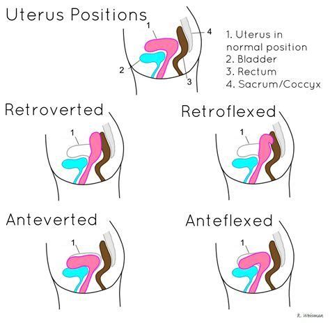 Pin by Erica Wilson on DMS | Medical ultrasound, Obstetric ultrasound ...