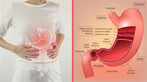 Reactive gastropathy definition, causes, symptoms, diagnosis & treatment