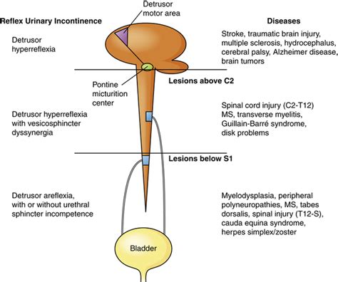 Alterations of Renal and Urinary Tract Function | Basicmedical Key