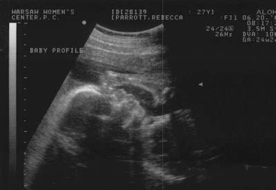 Baby Boy Parrott: 6 month Ultrasound