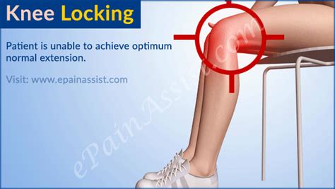 Knee Locking|What Causes Locked Knee and How is it Treated?