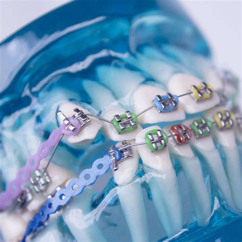 Orthodontic Appliances | Santa Clarita, California | Kidz Dental Care SCV and PR