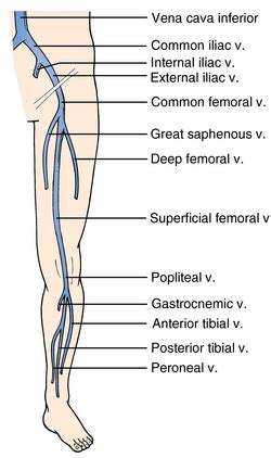 Ultrasonography for deep venous thrombosis | Clinical Gate