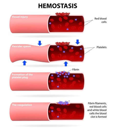 Proses Hemostasis