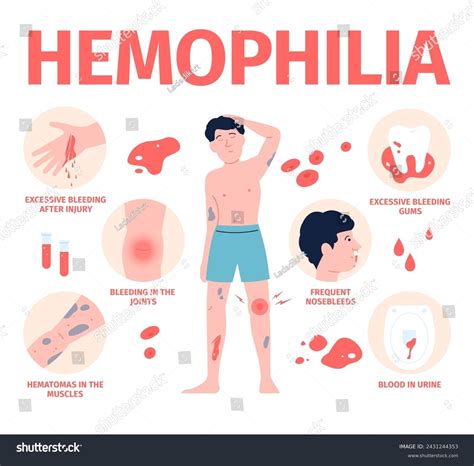 Hemophilia Symptoms Photos and Images | Shutterstock