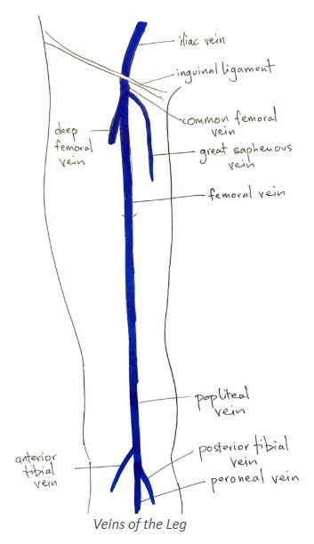 Popliteal Vein Dvt