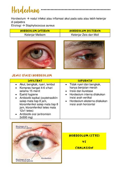 Hordeolum, Chalazion, Kelainan Kelopak dan Bulu Mata - Kelenjar Meibom ...