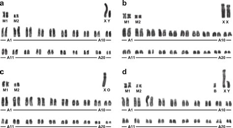 Aneuploid Chromosome Constitutions of the Small Japanese Field Mouse, Apodemus argenteus, in the ...