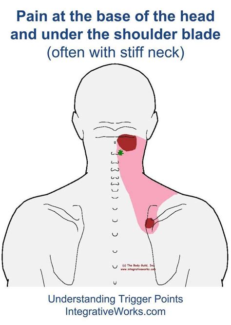 Pin on Fibromyalgia