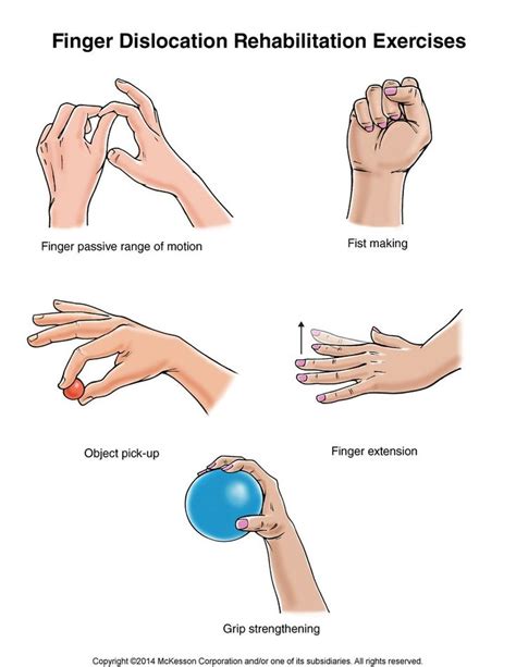 Dislocated Finger Joint Pictures and Treatment | Orthoped