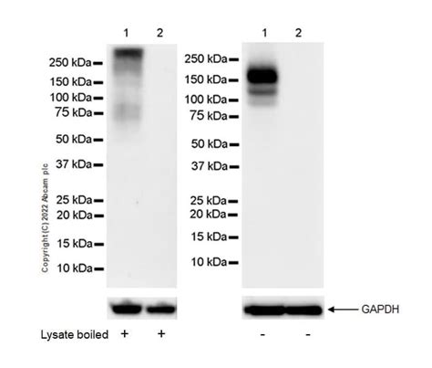 Recombinant Anti-F4/80 antibody [EPR26545-166] (ab300421) | Abcam