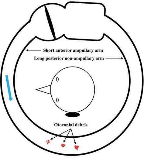 Forced prolonged positioning (FPP) in left lateral recumbent position... | Download Scientific ...