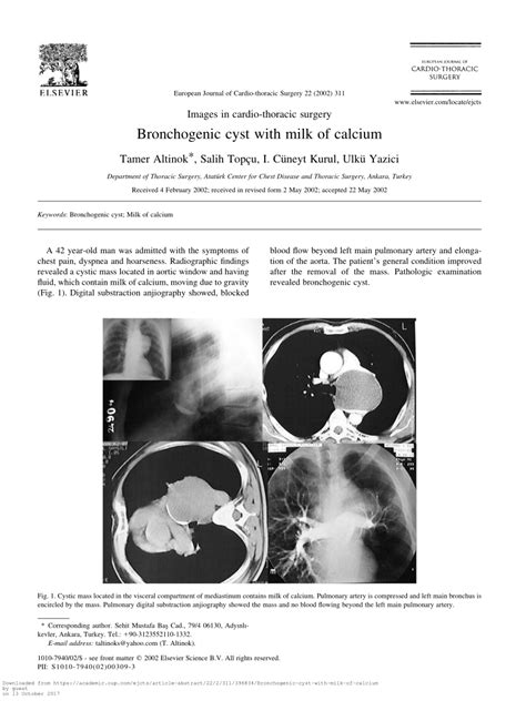 (PDF) Bronchogenic cyst with milk of calcium