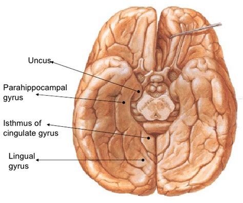 BrainMind.com