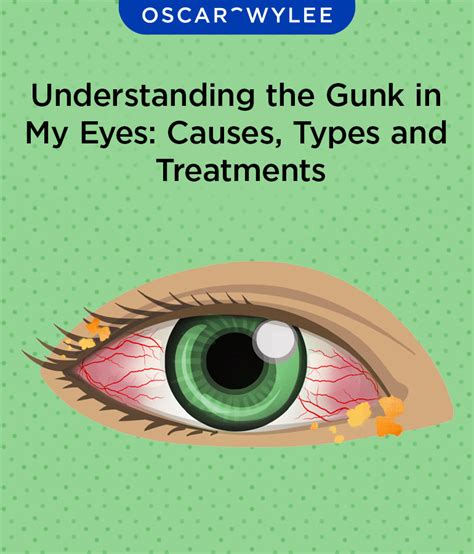 Understanding the Gunk in my Eyes: Causes, Types and Treatments