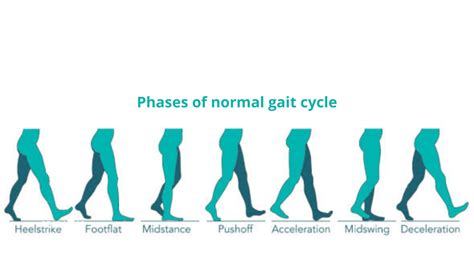 Things which help for better gait analysis - Physiofitfinder