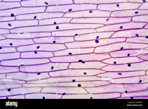 Onion epidermis (Allium cepa) showing cells and nucleus. Optical ...