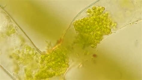 Seaweed (algae Anabena) Under Microscope, Magnification 100X (Differential Interference Contrast ...