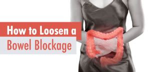 How to Loosen a Bowel Blockage - Life Infused How to Loosen a Bowel Blockage