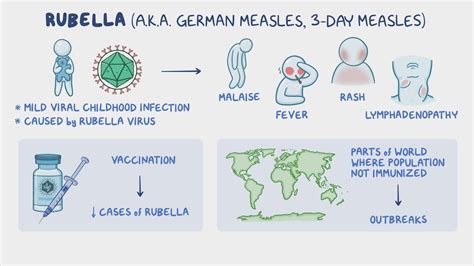 Rubella (German measles): Nursing - Osmosis Video Library