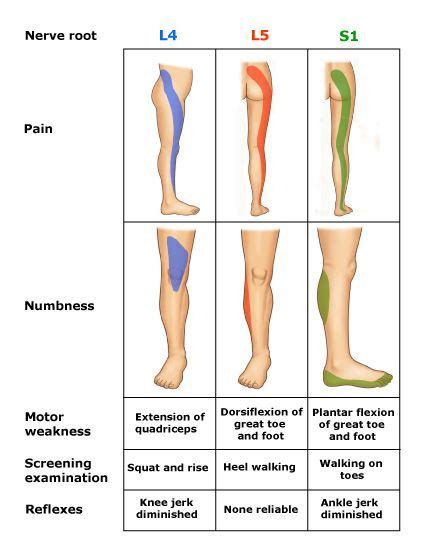 Sciatica Exercises, Back Pain Exercises, Hip Flexor Exercises, Knee Exercises, Muscle Anatomy ...