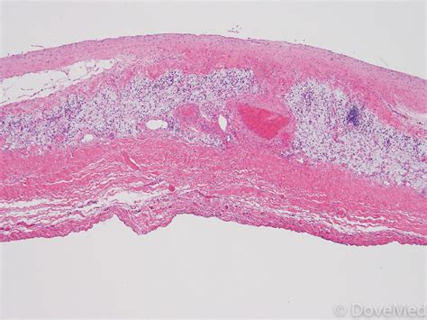 Histologia Pericardio