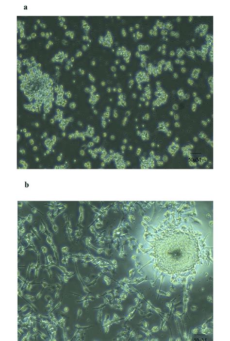 Graphs indicating the morphology of adherent cells derived from... | Download Scientific Diagram