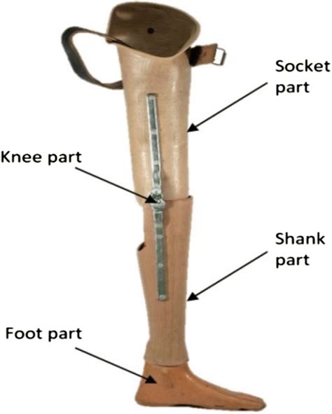 ABOVE KNEE AMPUTATION : Indication, Exercise, Prosthesis