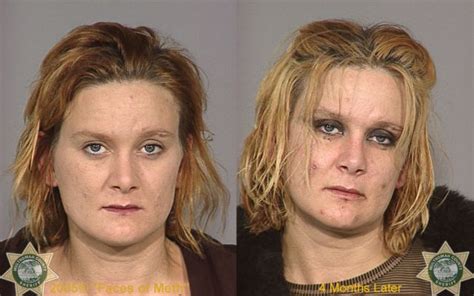 Meth Addicts: Before and After (38 pics) - Izismile.com