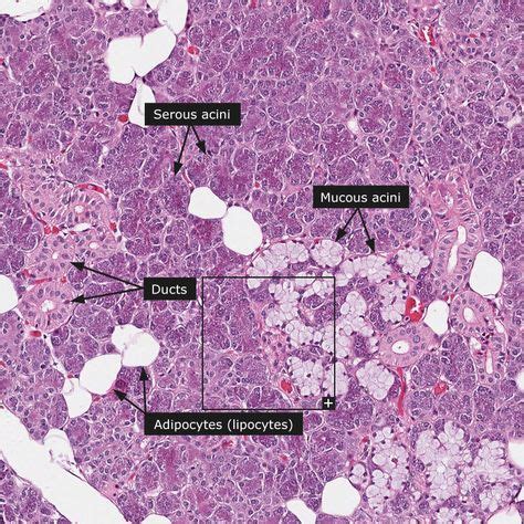 Parotid gland