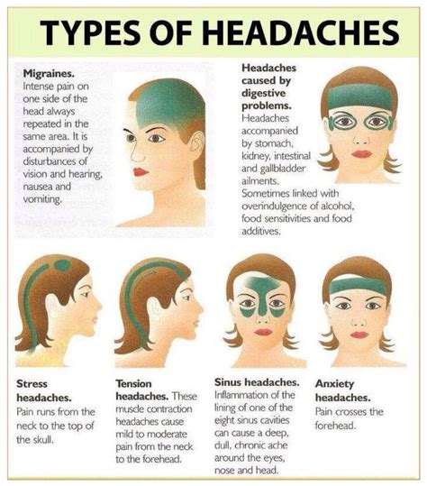 This is good to know... | Headache types, Migraines remedies, Migraine