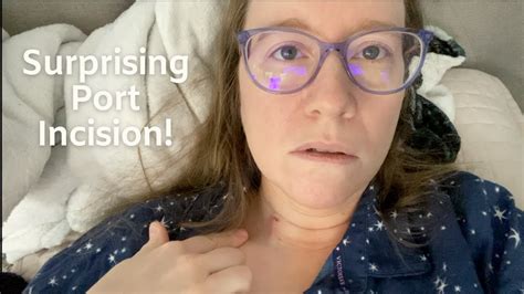 Surprising Port a Cath incision! (Day of Surgery) - YouTube