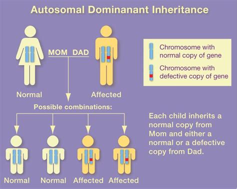 Pin on Huntington's Disease