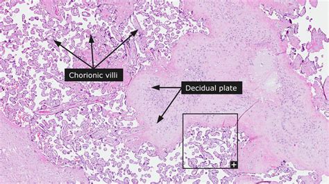 Dictionary - Normal: Placenta - The Human Protein Atlas