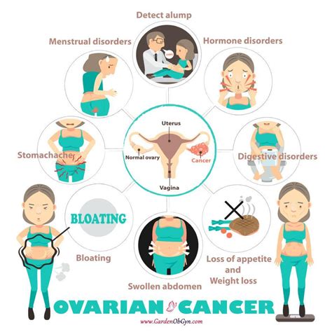 How Do You Know If You Got Ovarian Cancer - CancerWalls