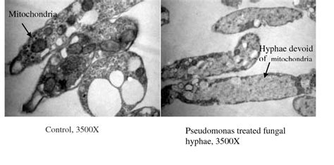 TEM (Magnification 3500X) showing number of mitochondria in control and ...