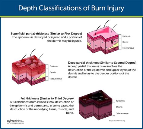 Burn Injury Nursing Care Management and Study Guide