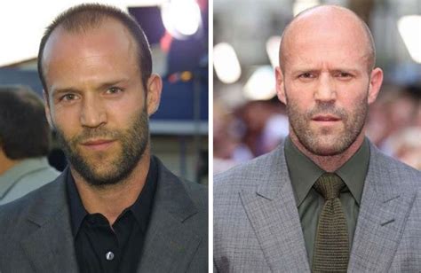 19 Bald Celebrities Before & After Embracing Baldness