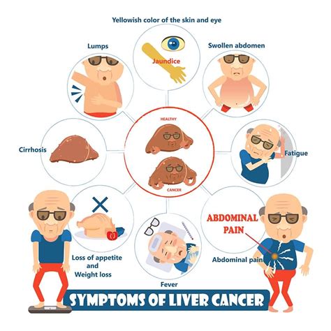 15 Signs and Symptoms of Liver Cancer You Should Not Ignore