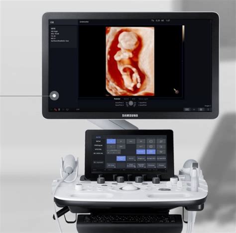 Samsung HS40 Obstetrics Gynecology Ultrasound System, सैमसंग अल्ट्रासाउंड मशीन - Samsung ...