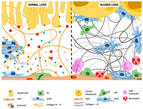 Space of Disse, home for hepatic stellate cells (HSCs). In healthy... | Download Scientific Diagram